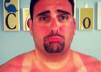 50 уморительных фото из серии “не спите на пляже” или “неудачный загар”